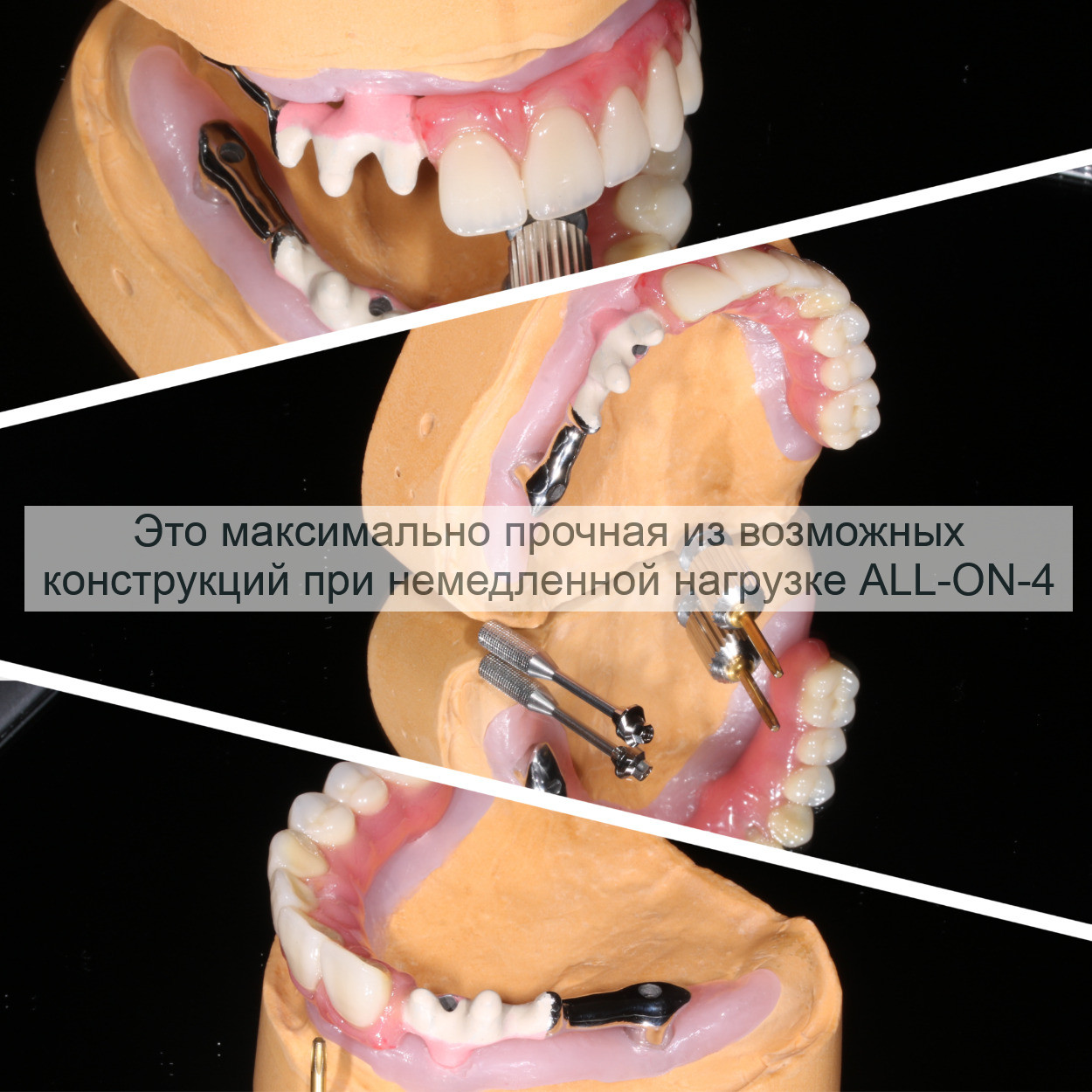 Все На 4 Фото